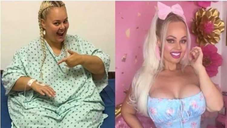 سيدة تتحول إلى باربي بعد خسارتها 88 كيلو من وزنها