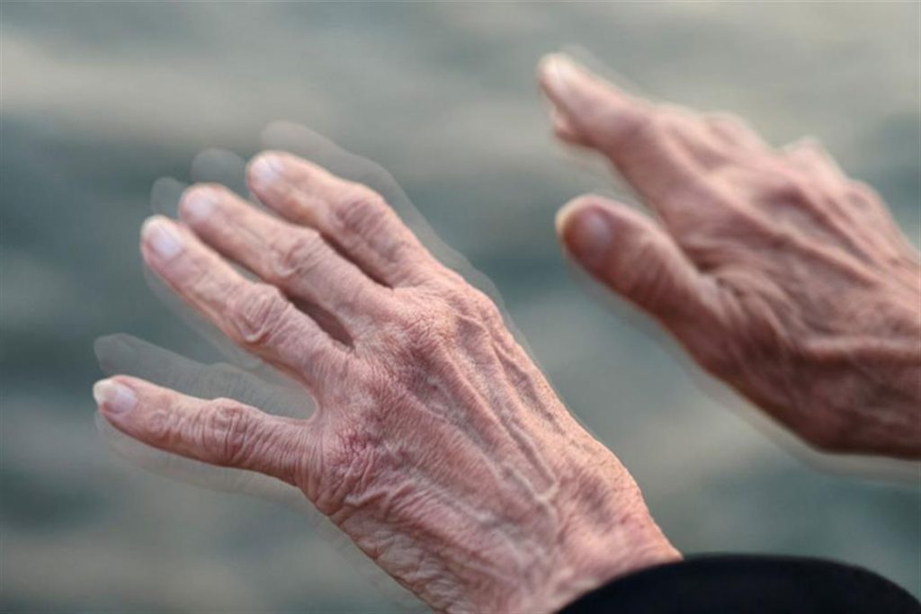 دراسة تكشف عن أمل جديد في علاج مرض باركنسون