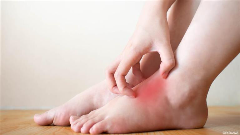 هل تعاني من حكة القدمين ليلا؟.. إليك ما يكشفه جسمك