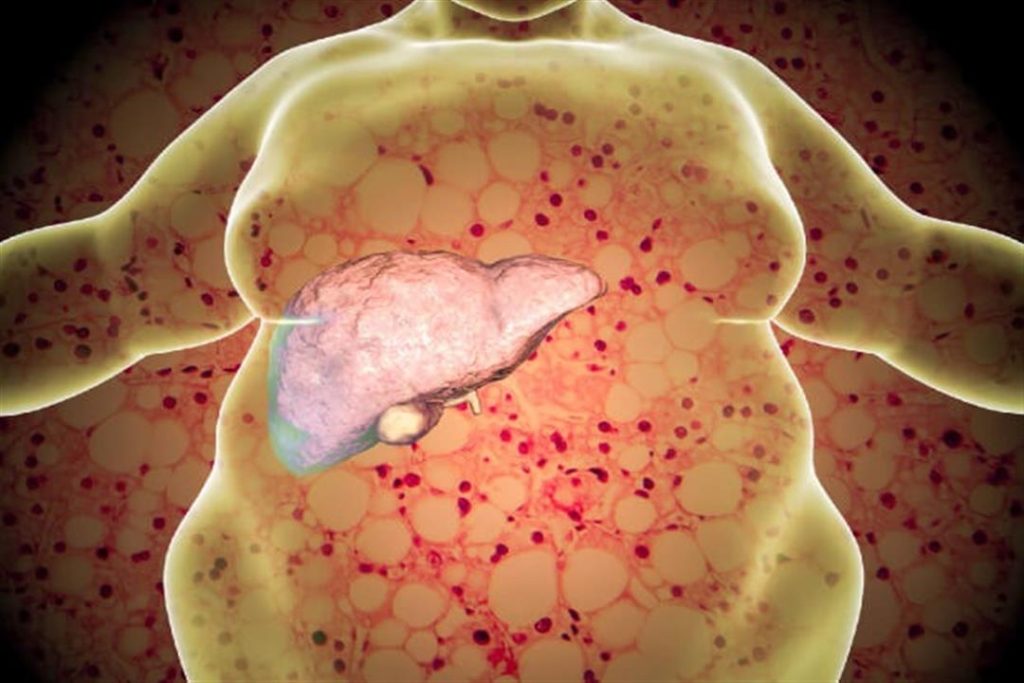 تظهر في الفم.. 5 أعراض تحذيرية تكشف إصابتك بمرض الكبد