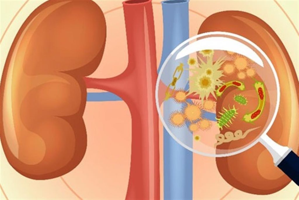احذر تناوله مع اللحمة الضاني في العيد.. خضار شهير يدمر كليتك