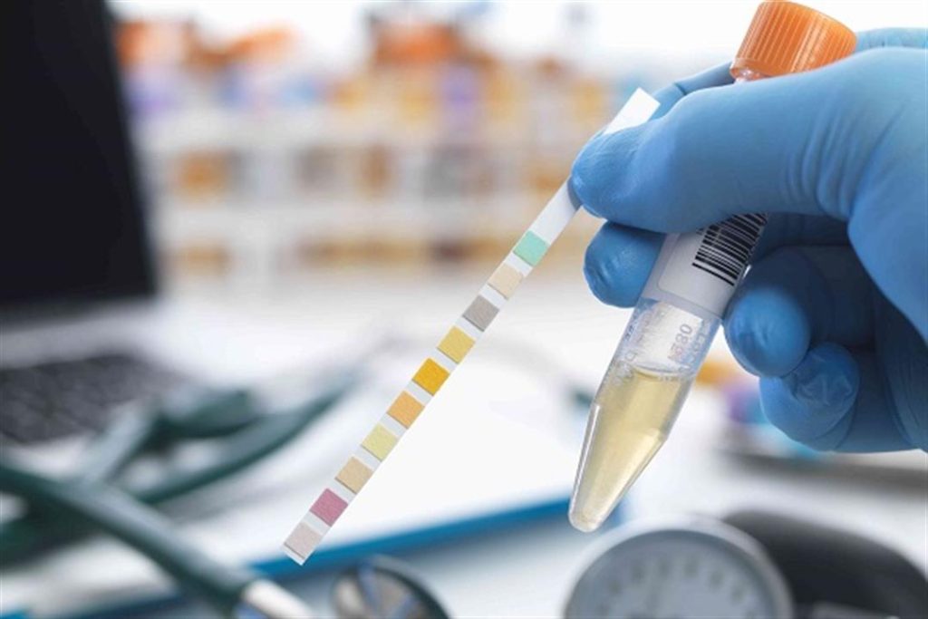 رائحة البول الكريهة علامة على 7 مشكلات صحية.. بعضها شديد الخطورة