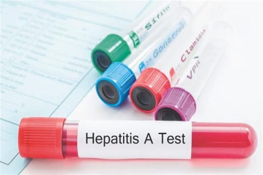 لو هتصيف برة.. ما التطعيمات الضرورية ضد التهاب الكبد A قبل السفر