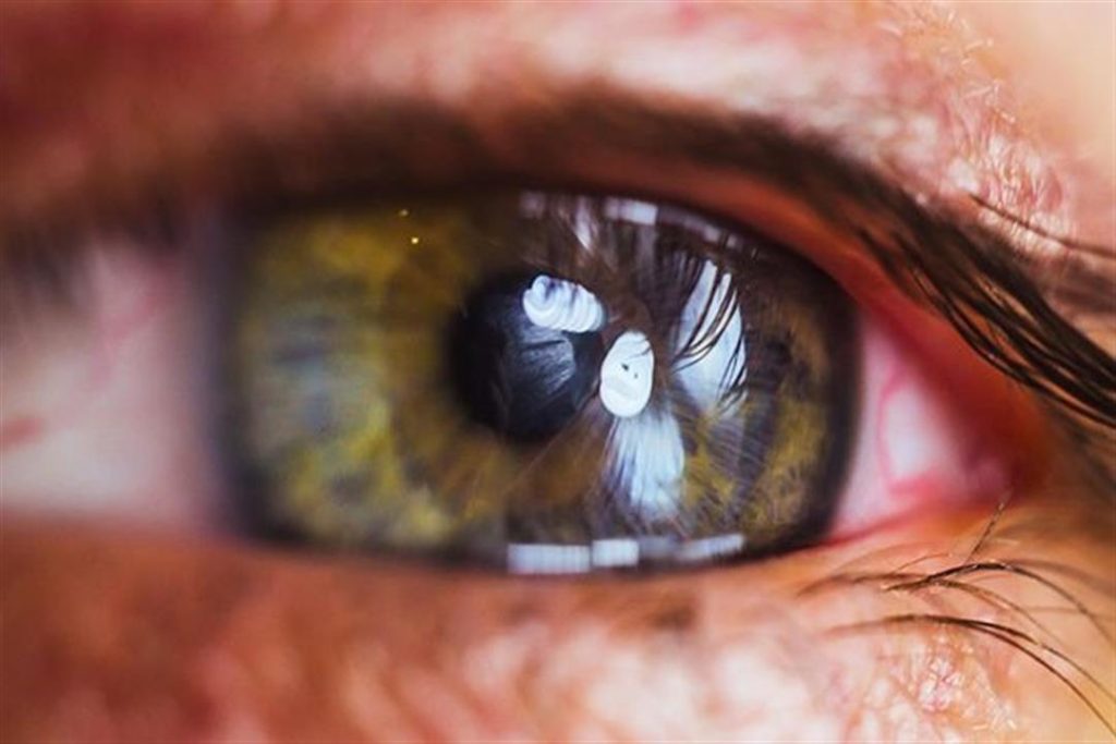 5 علامات تدل على ارتفاع مضاعف للكوليسترول في الدم.. راقب عينيك