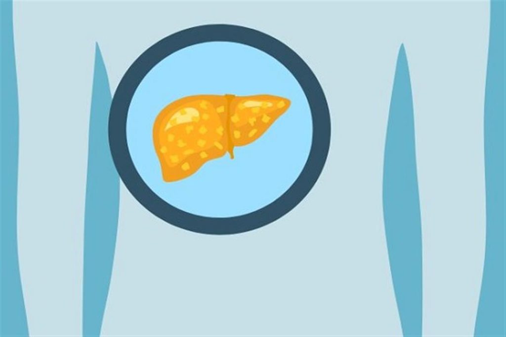 للنحفاء.. اكتشاف سبب جديد لارتفاع الوفاة بمرض الكبد الدهني