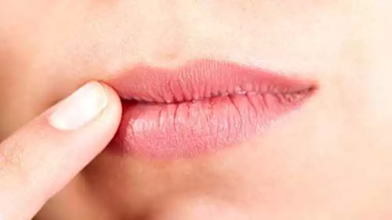تشقق الشفاه في الشتاء.. إليك الأسباب والعلاج
