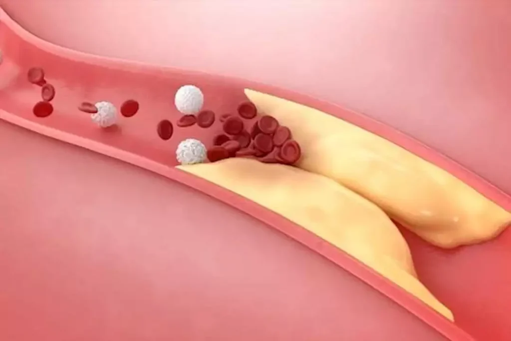 أكلة سحرية تخفض الكوليسترول في الدم.. تناولها قبل النوم