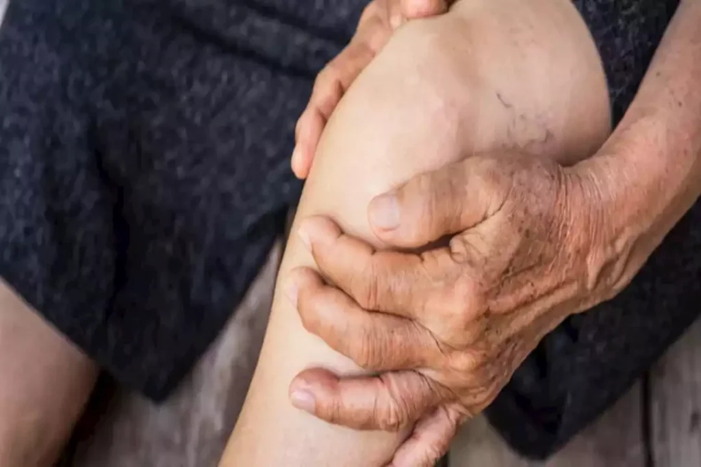 خيار آمن وفعال.. دعامات الركبة أفضل علاج لالتهاب المفاصل