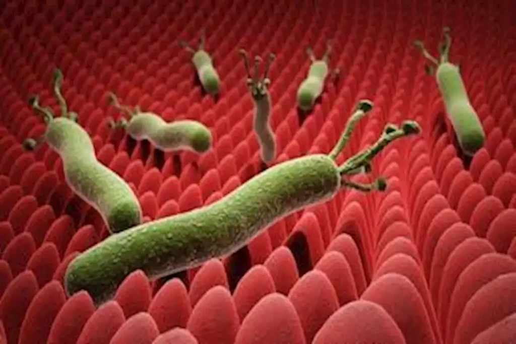 تظهر عند الاستيقاظ.. 5 أعراض تكشف إصابتك بجرثومة المعدة