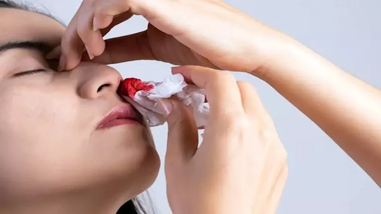 نزيف الأنف علامة تكشف ارتفاع ضغط الدم المرتفع.. لا تتجاهلها