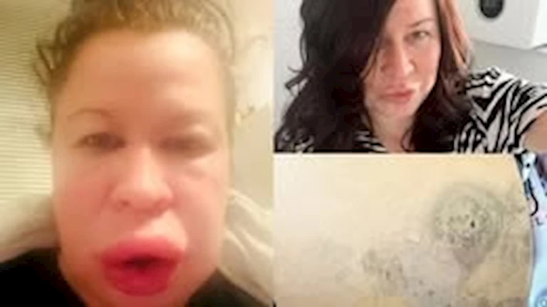 في منزلك.. صور سيلفي تكشف عن القاتل الصامت – يدمرك دون أن تدري