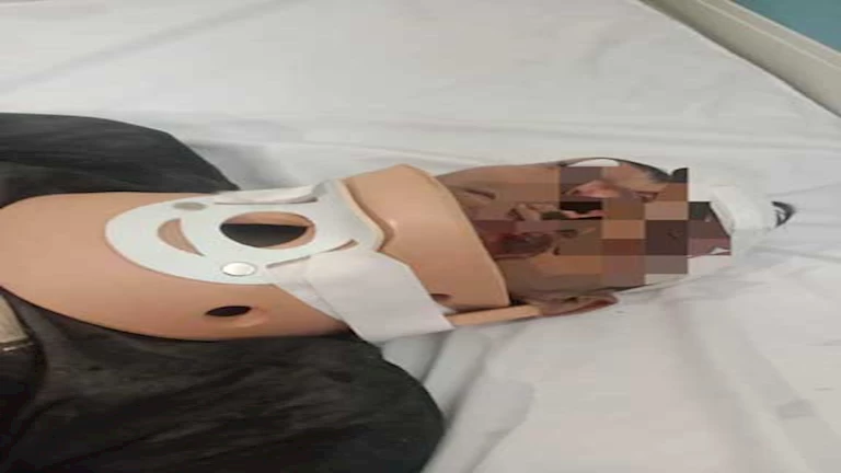 للمرة الأولى بـ”صحة الدقهلية”.. نجاح جراحة دقيقة لإصلاح كسر بالرقبة في تمى الأمديد (صور)