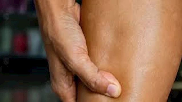 ما أضرار احتباس السوائل في الجسم؟