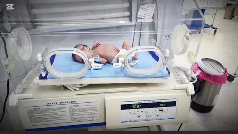 فريق طبي بمستشفى ميت غمر ينقذ حياة طفل رضيع وُلد بأمعاء خارج الجسم -صور