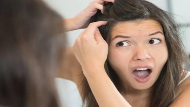 طبيبة تكشف أسباب ظهور الشيب المبكر