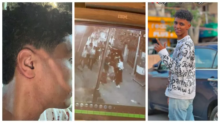 “89 غرزة في الوجه”.. تفاصيل الاعتداء على طالب أمام سنتر تعليمي بروض ال