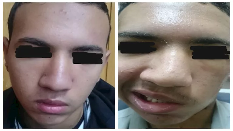 فريق طبي بجامعة أسيوط يعيد الحياة لشاب بعد إصابة حرجة (صور)