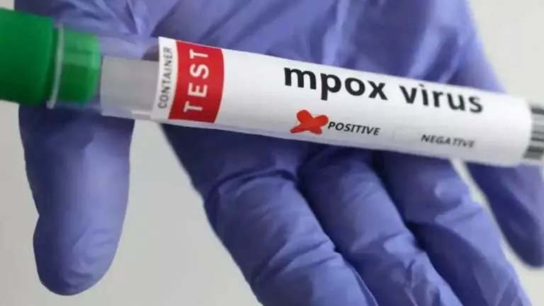 غانا تسجّل أول وفاة بفيروس “إمبوكس”