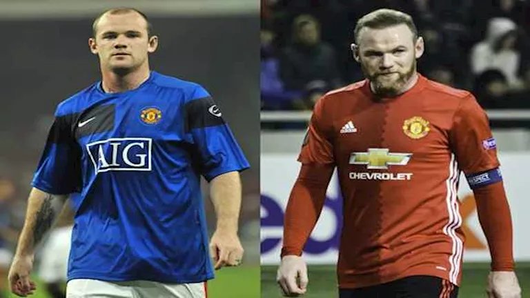 25 صورة لنجوم كرة القدم قبل وبعد زراعة الشعر