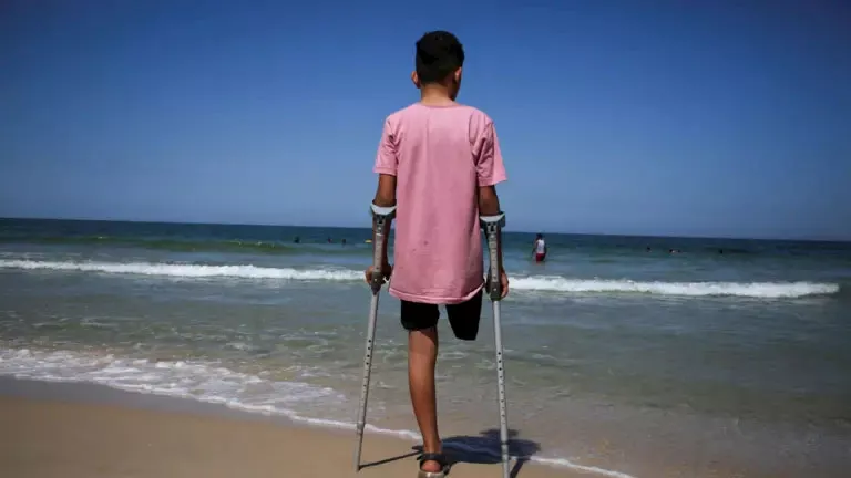 مبتورو الأطراف في غزة.. محرومون من العلاج والتأهيل والسفر