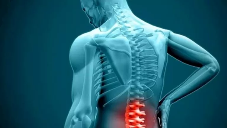 6 نصائح فعالة للوقاية من الانزلاق الغضروفي