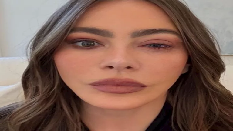 بعين متورمة.. ممثلة شهيرة تكشف السبب وراء عدم حضور حفل الإيمي 2025