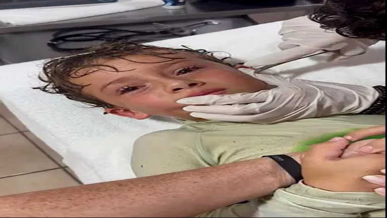 طبيب يستخرج سرطان بحر حي من أذن صبي- فيديو صادم