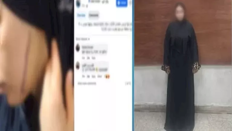 رفض استئناف المتهمة بتشويه وجه خطيبة طليقها بـ41 غرزة على حبسها احتياط