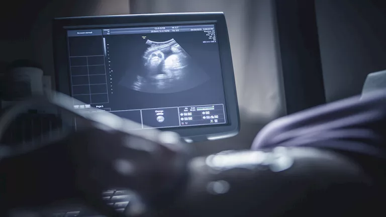 كيف يؤثر تلوث الهواء على دماغ الأطفال حديثي الولادة؟