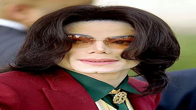 تقرير التشريح يكشف معاناة مايكل جاكسون الصحية المخفية