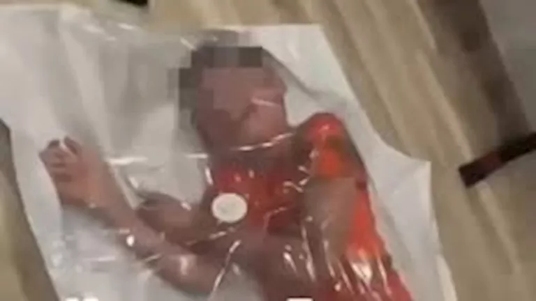 سيدة تضع طفلها داخل حقيبة بلاستيك لسبب غريب