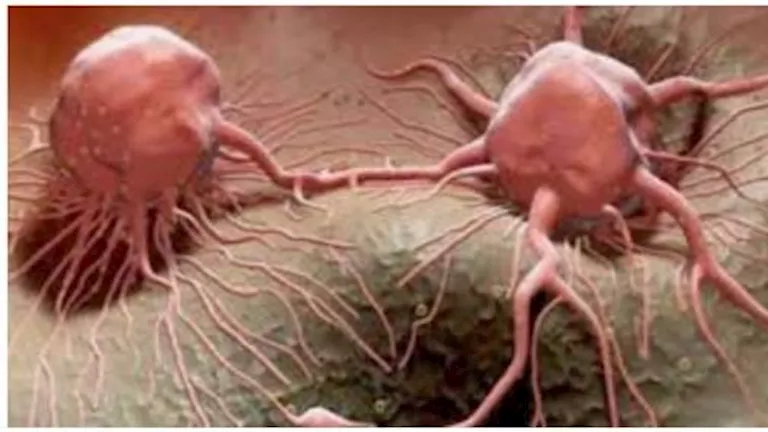 أطعمة يجب الحذر منها.. تحفز الخلايا السرطانية